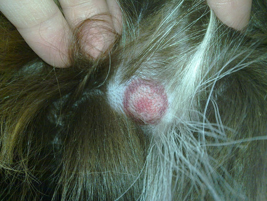 Lyme Disease / Ticks